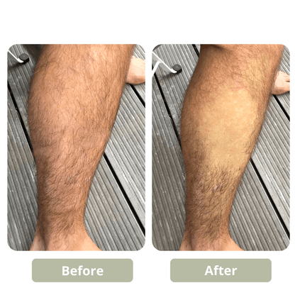 GET SMOOTH PAINLESS! - CRYSTAL HAIR ERASER