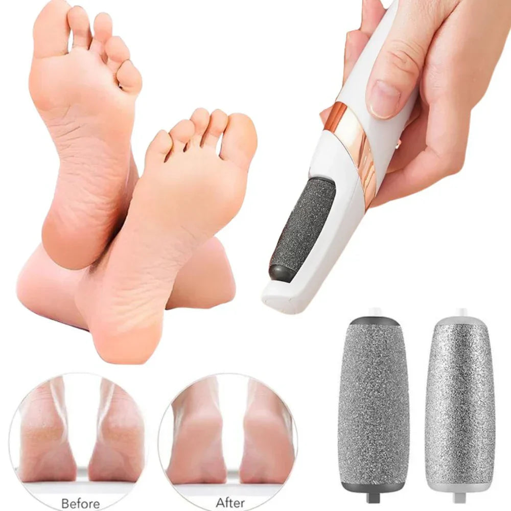Electric Callus Remover for Feet